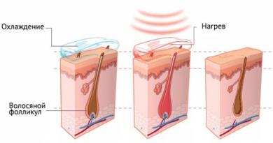 Поможет ли лазерная эпиляция в домашних условиях избавиться от нежелательных волос